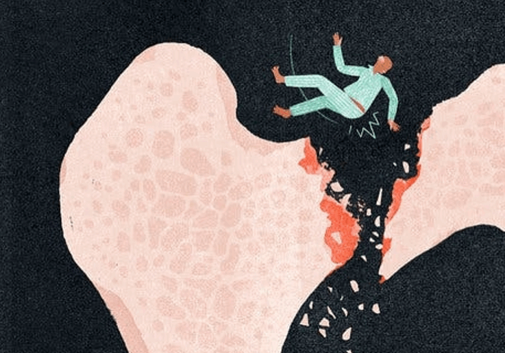 Benskjørhet og brudd